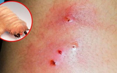 Casos de miasis provocados por el gusano barrenador