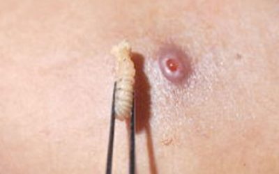 La doble vara del asilo