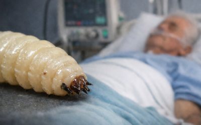 Puebla registra su primer caso humano de gusano barrenador en adulto mayor